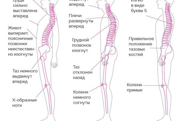 Аналог гидры